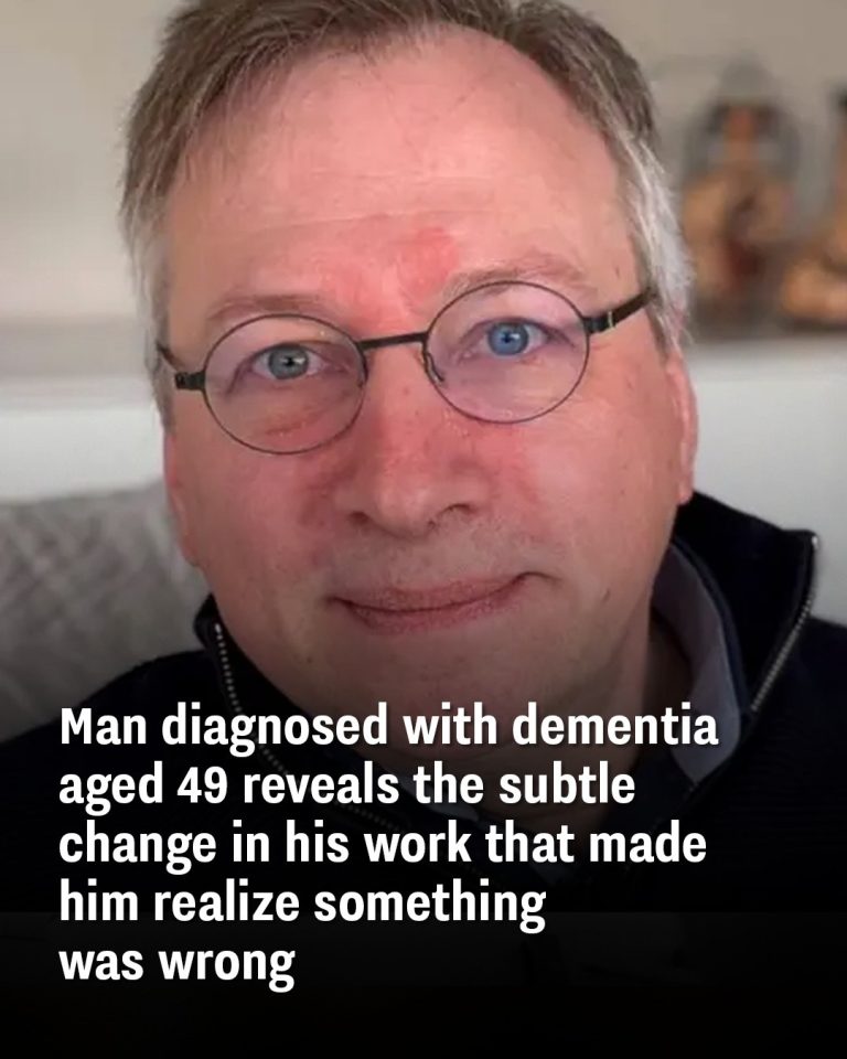 After Being Diagnosed With Dementia at 49, Man Realized The Subtle Red Flag in His Work That Made Him Realize Something Was Wrong