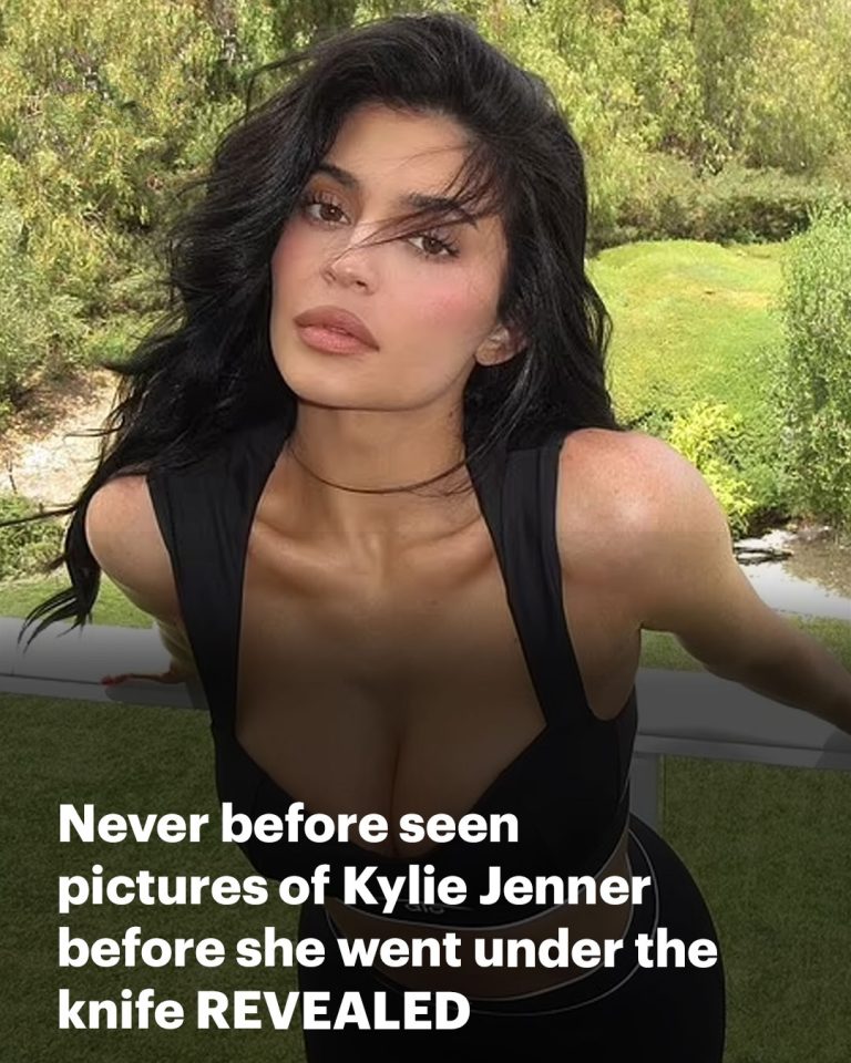 Radio stars share never before seen pictures of Kylie Jenner before she went under the knife after they called her the ‘ugly little one’