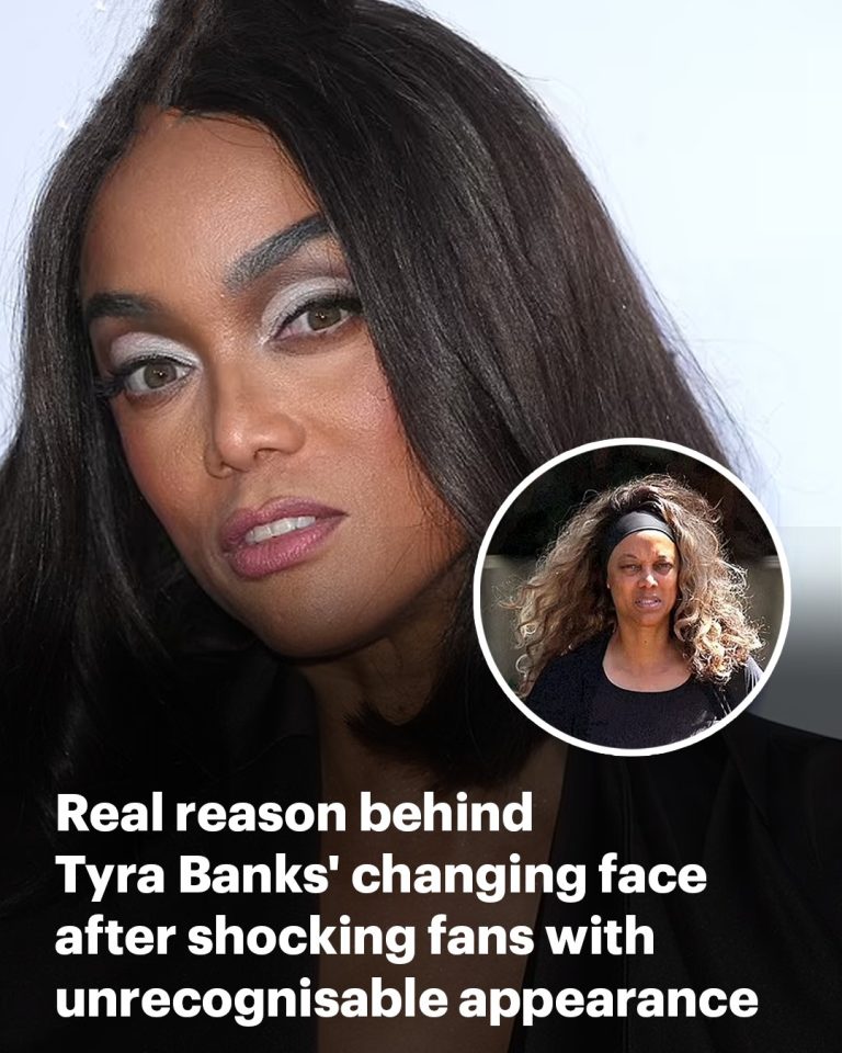Tyra Banks’ changing face: Plastic surgery expert weighs in after model’s unrecognizable red carpet moment