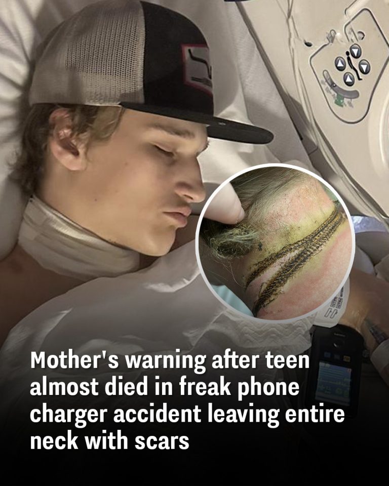 Mother’s warning after teen almost died in freak phone charger accident leaving entire neck in scars