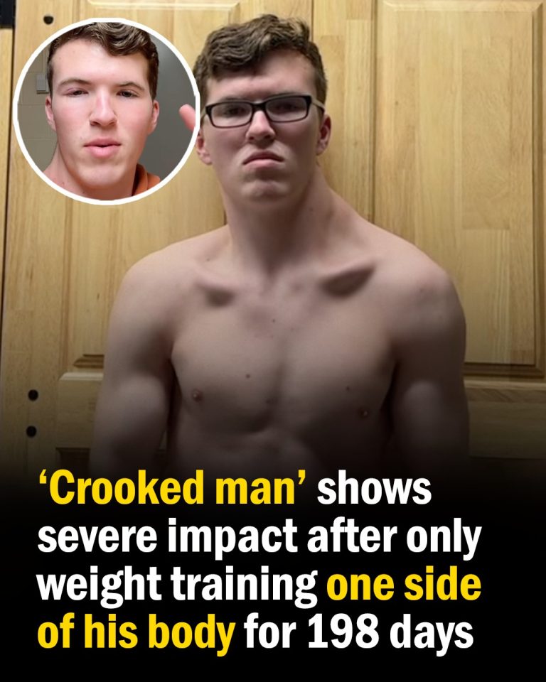 Teen Trains One Side of His Body for 198 Days, the Transformation Is Shocking