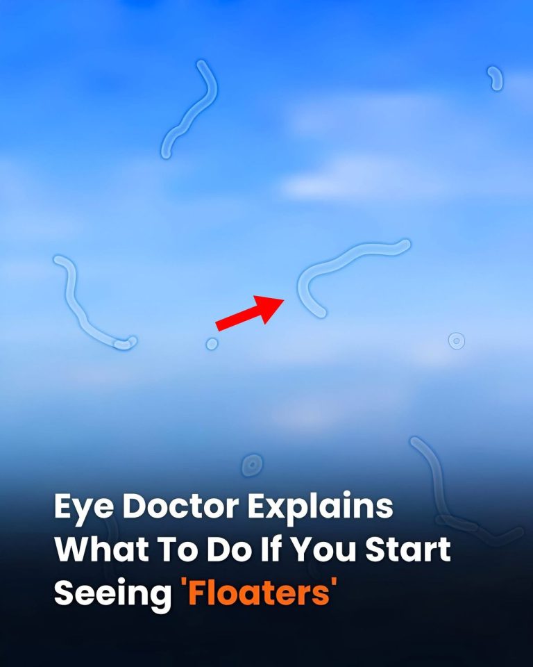 What Are Eye Floaters? Here What To Do If you Start Seeing Them, According to an Eye Doctor