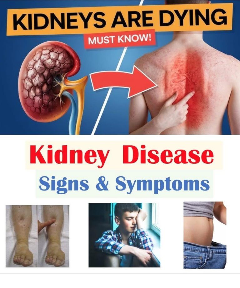 If Your Kidneys Are in Danger, the Body Will Show these 10 Signs
