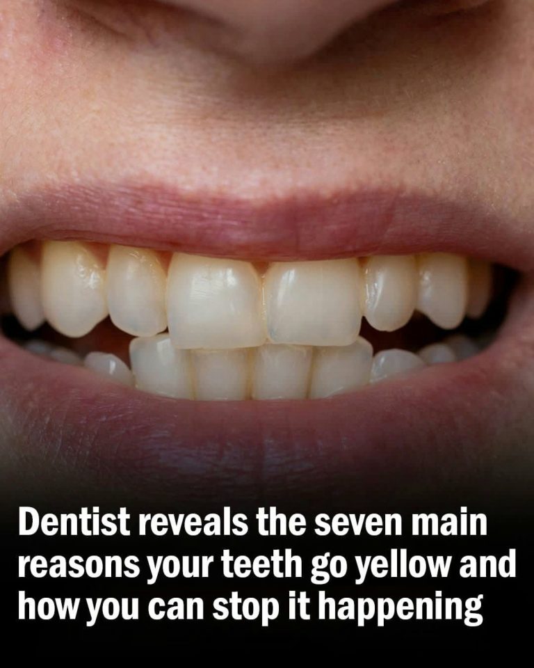 Dentist Explains 7 Key Causes of Yellowing Teeth and How to Prevent It