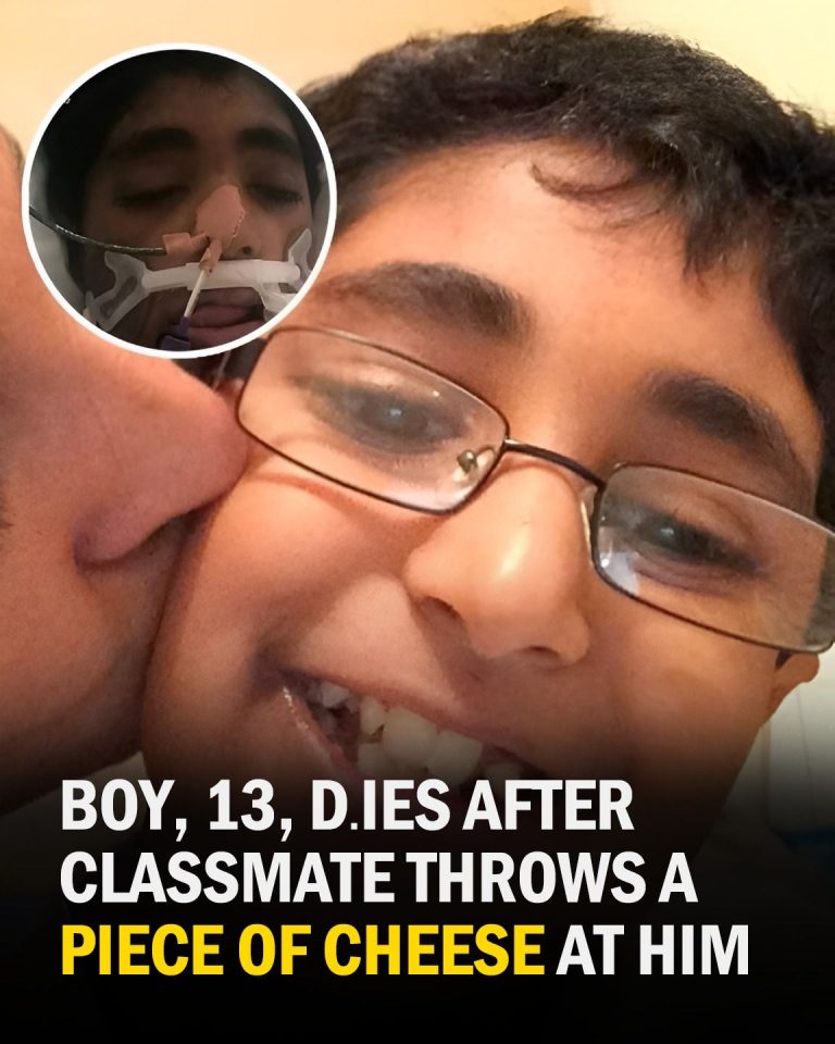 Teen Boy With Severe Dairy Allergy Dies After Piece of Cheese Thrown At Him