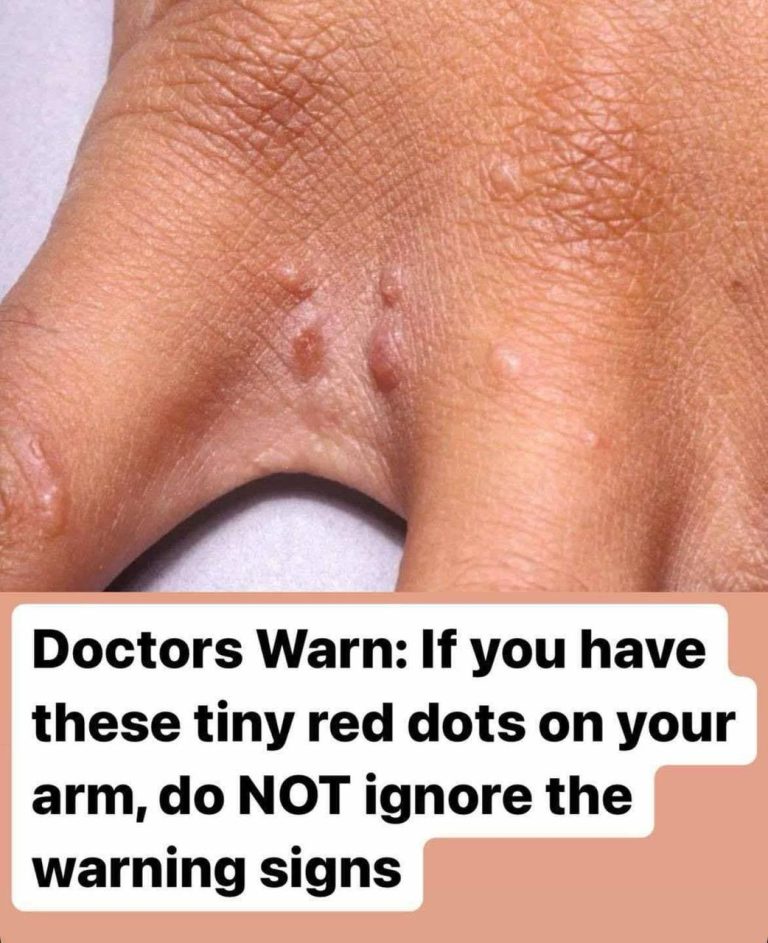 Itchy Red Spots on Your Skin? Don’t Ignore This Common but Misunderstood Condition