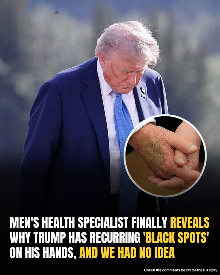Men’s Health Specialist Finally Reveals Why Trump Has Recurring ‘Black Spots’ On His Hands, And We Had No Idea