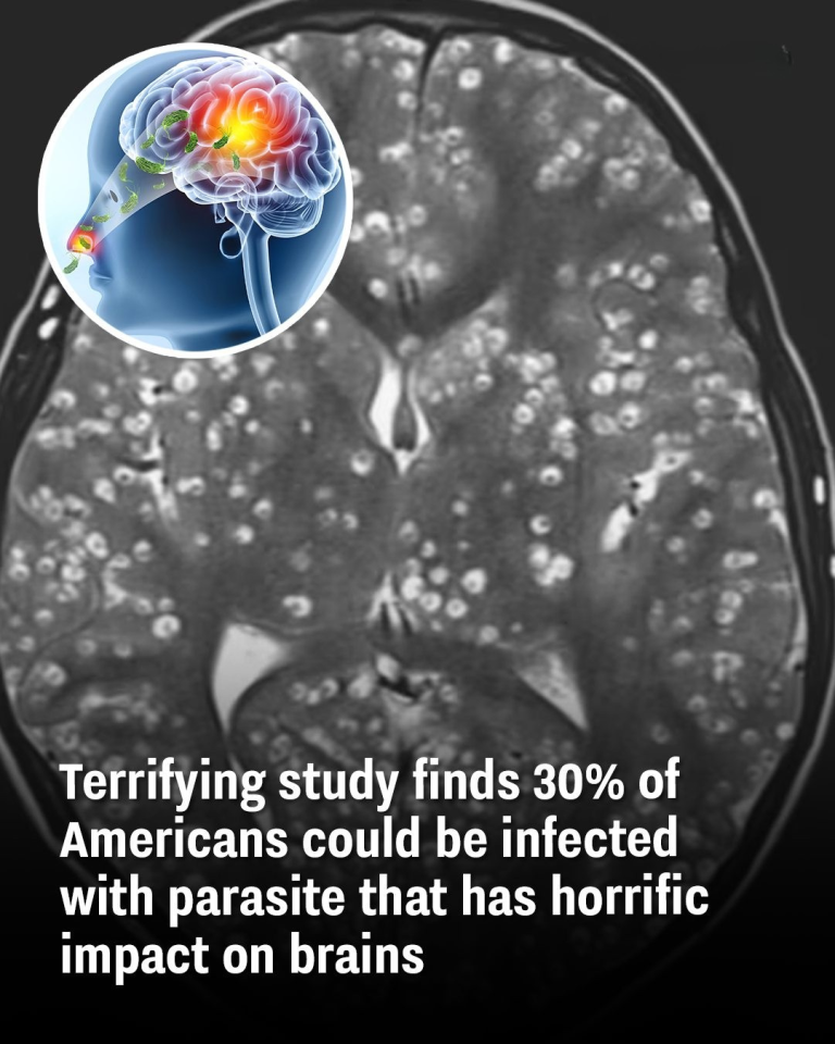 Terrifying study finds 30% of Americans could be infected with parasite that has horrific impact on brains
