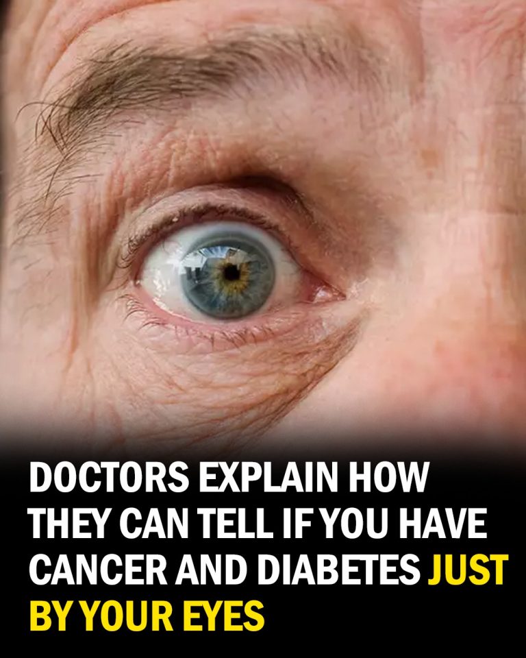 Can Your Eyes Reveal Diabetes or Cancer? Don’t Miss the Signs