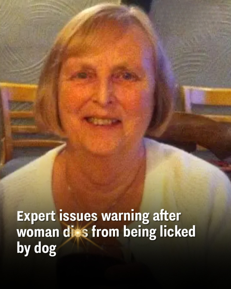 Expert issues warning after woman dies from being licked by dog